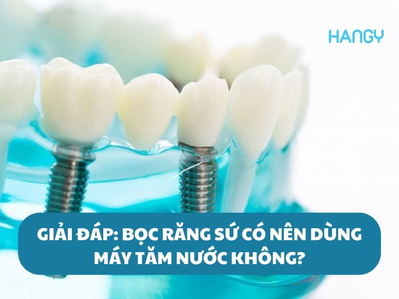 Giải đáp: Bọc răng sứ có nên dùng máy tăm nước không?