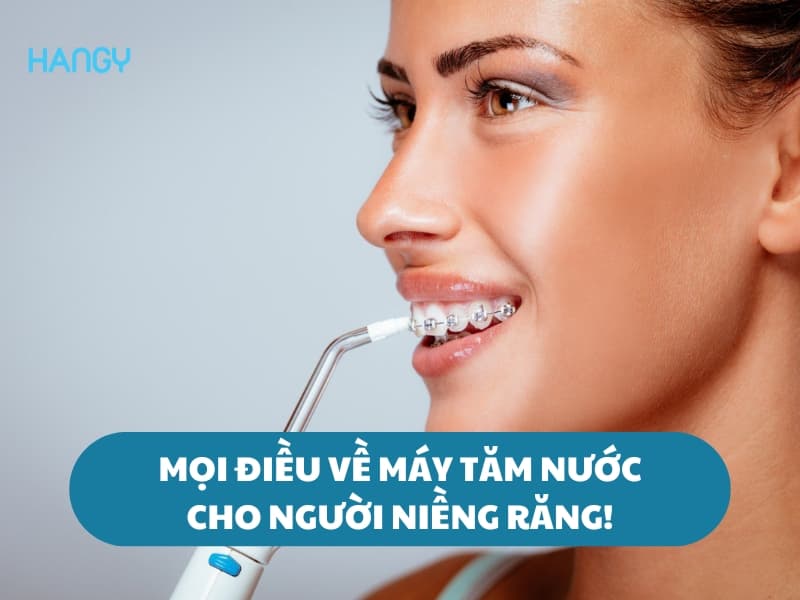 Mọi điều về máy tăm nước cho người niềng răng bạn nên biết!