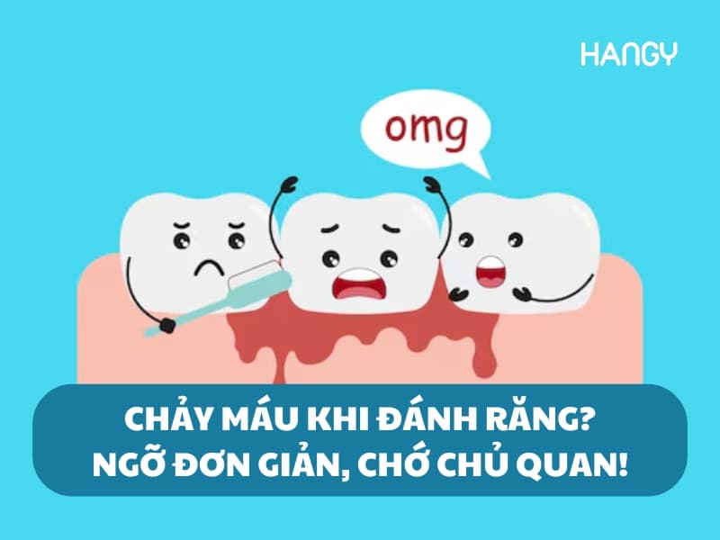 Chảy máu khi đánh răng - ngỡ là đơn giản nhưng chớ chủ quan!