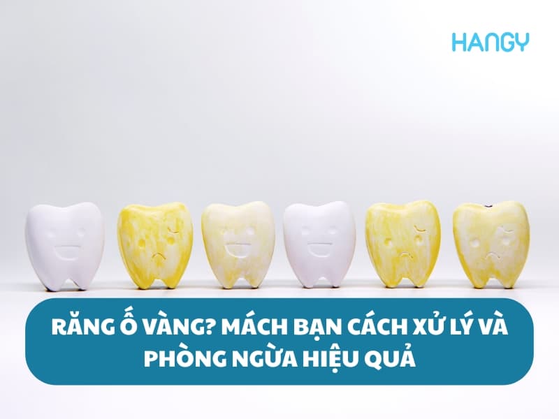 Răng ố vàng: Mách bạn cách đánh bay xỉn màu, phòng ngừa hiệu quả!