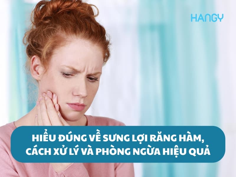 Hiểu đúng về sưng lợi răng hàm, cách xử lý và phòng ngừa hiệu quả